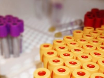 trays of test tubes with different-colored caps