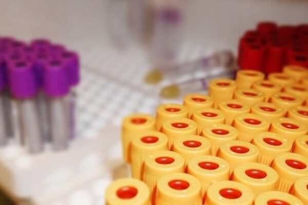 trays of test tubes with different-colored caps